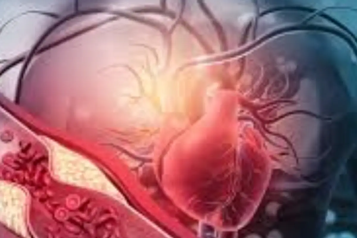 Hai avuto un infarto? Ecco il valore di colesterolo cattivo che devi assolutamente raggiungere